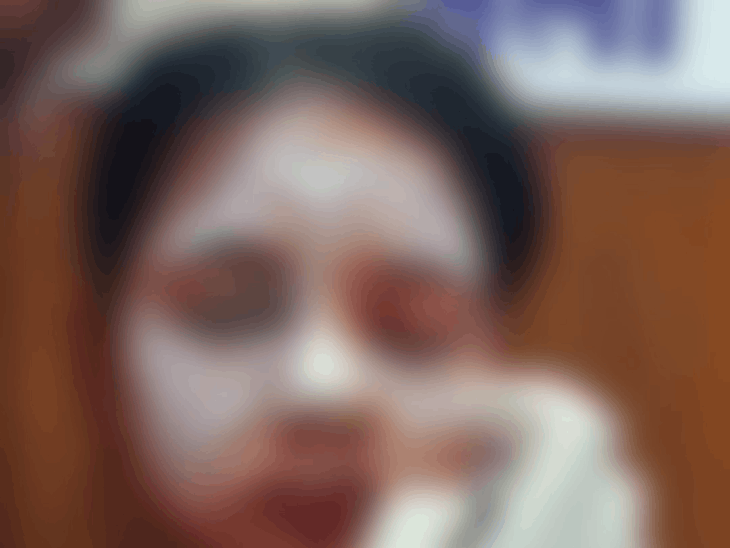 Balod Acid Attack Case: युवती पर एसिड अटैक का 8 घंटे में खुलासा, प्रेमी समेत 2 आरोपी गिरफ्तार